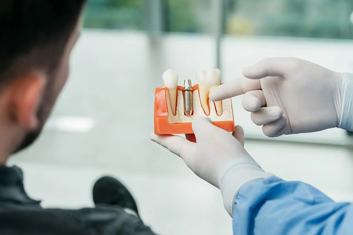 Ali veste, kako lahko rešite težavo z manjkajočimi zobmi? | Stomatološka poliklinika Zagreb | Štimac centar dentalne medicine
