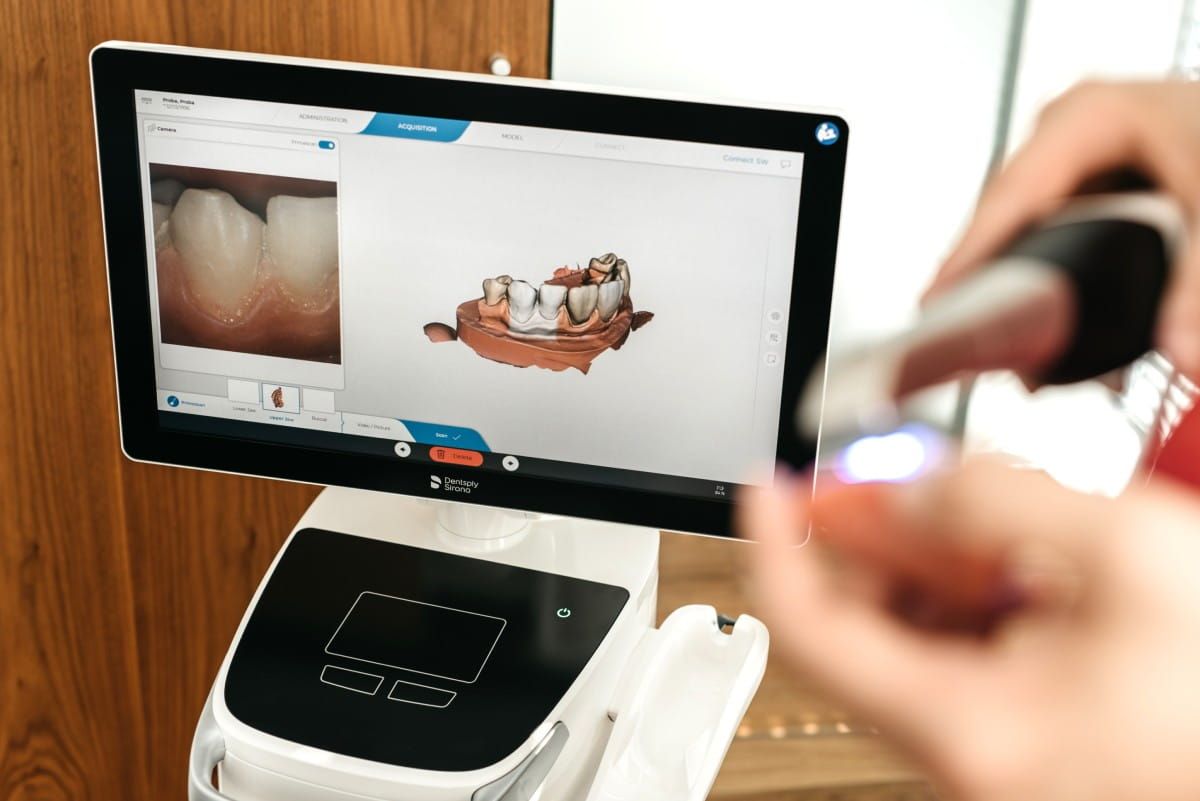 Pozabite na neprijetno odvzemanje odtisa pri zobozdravniku | Stomatološka poliklinika Zagreb | Štimac centar dentalne medicine