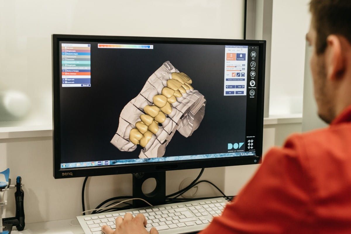 Pozabite na neprijetno odvzemanje odtisa pri zobozdravniku - Stomatološka poliklinika Zagreb | Štimac centar dentalne medicine