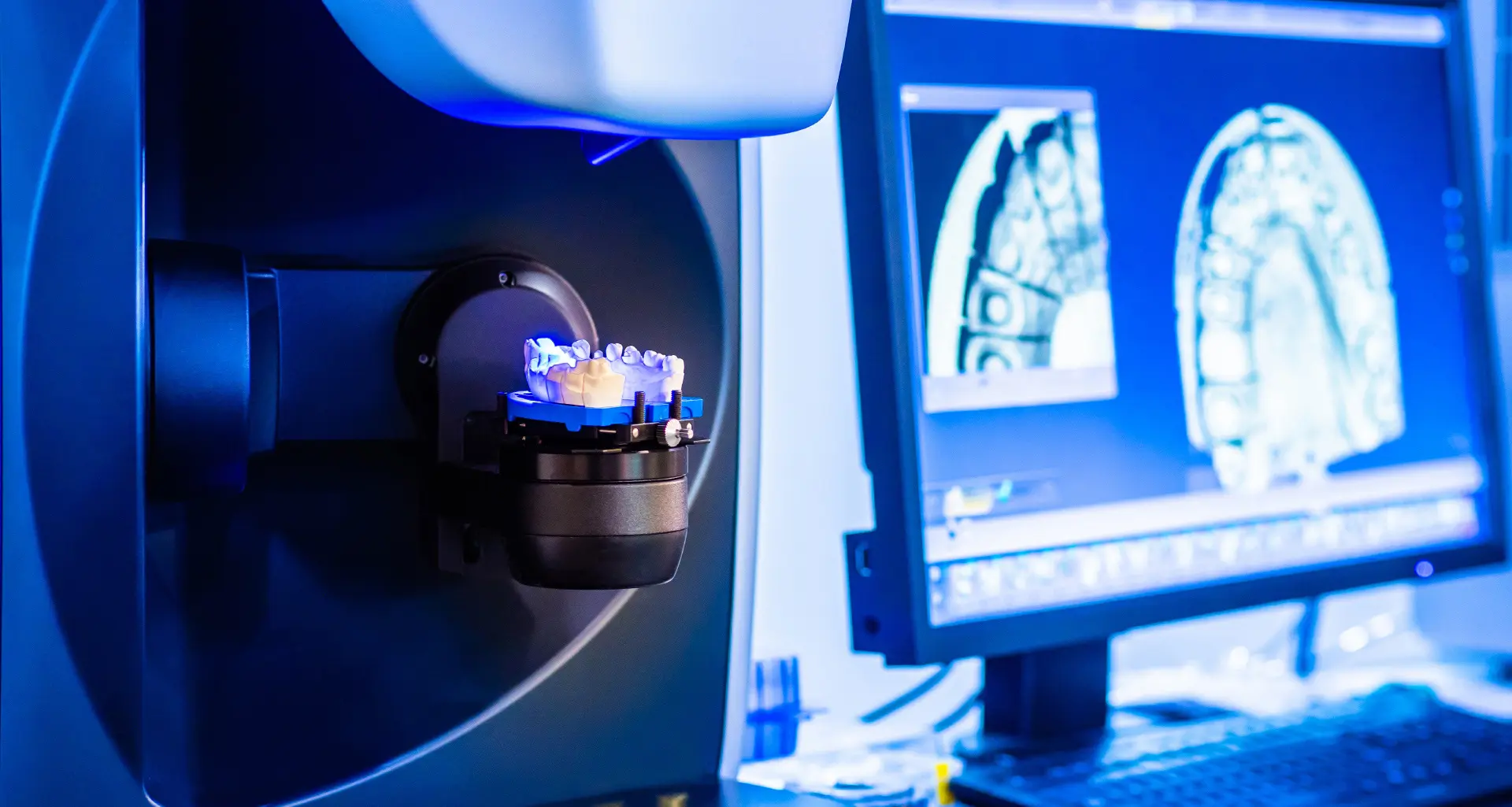 CAD-CAM tehnologija - CAD-CAM tehnologija | Štimac centar dentalne medicine