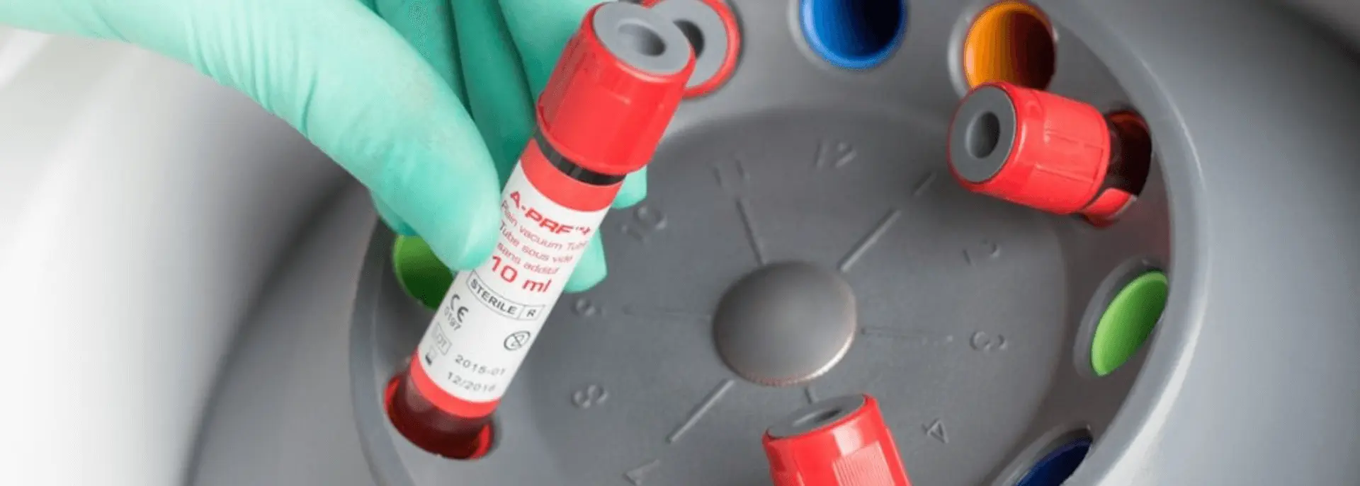 PRF protokol - PRF protokol | Štimac centar dentalne medicine