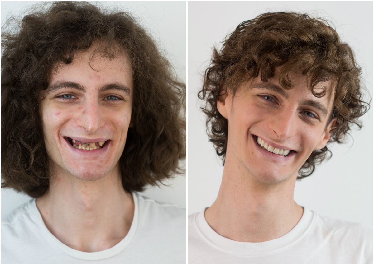 O nas | 2. slika za Rezultati postopka