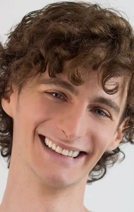 Dentalni makeover | Stomatološke usluge | Štimac centar dentalne medicine