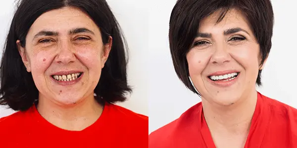 Makeover 2014. | Makeover 2014 | Stomatološka poliklinika Štimac | Zagreb | Ankica