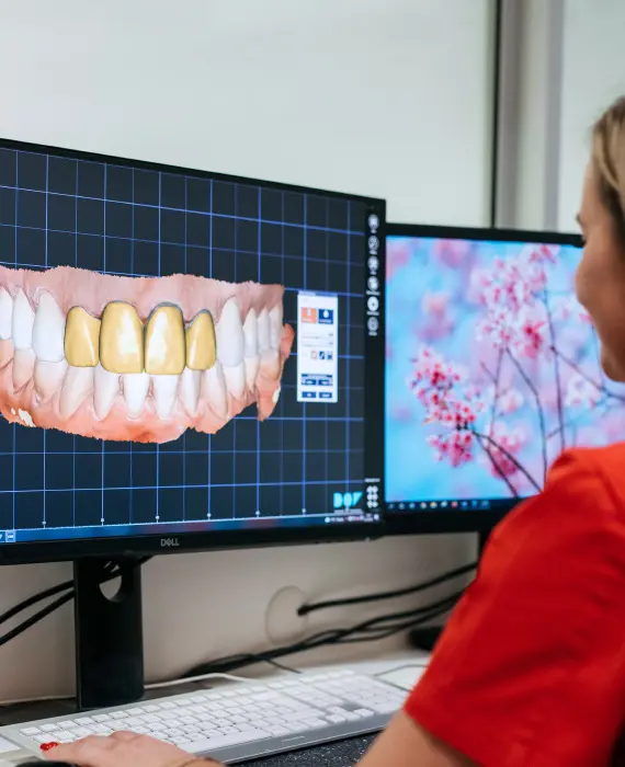 Zobotehnični laboratorij | CAD-CAM TEHNOLOGIJA