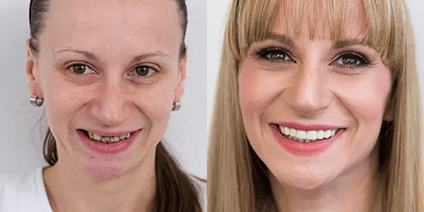 Makeover 2015. | Makeover 2015 | Ida