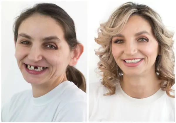 Makeover 2017. | Makeover 2017 | 