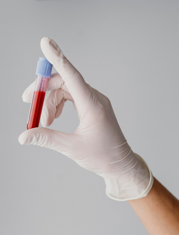 PRF protokol | ŠTO JE PRF PROTOKOL?