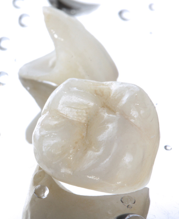 Zobne krone | KAJ SO ZOBNE KRONE?