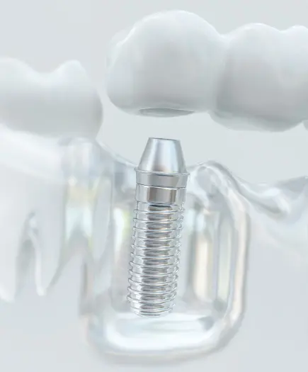 Storitve | Stomatološke usluge | Štimac centar dentalne medicine