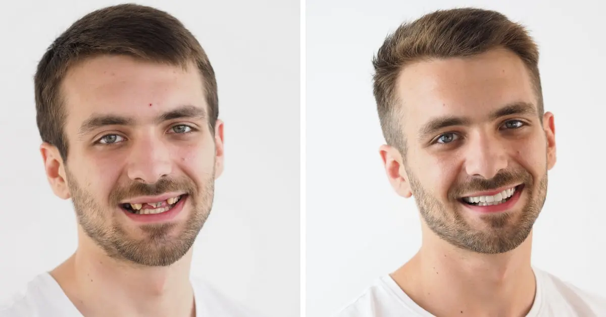 Makeover 2018. | Makeover 2018 | Josip