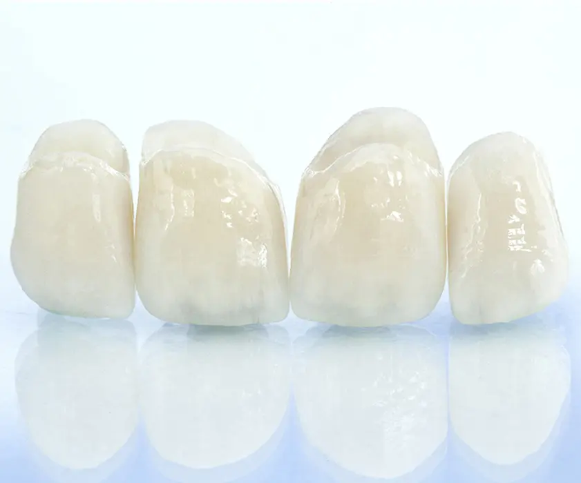 Zobna protetika | Zubna protetika | Stomatološka poliklinika Zagreb | Štimac centar dentalne medicine