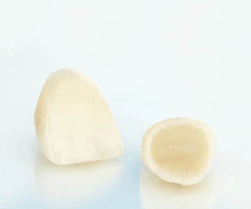 Zobne krone | Stomatološka poliklinika Zagreb | Štimac centar dentalne medicine