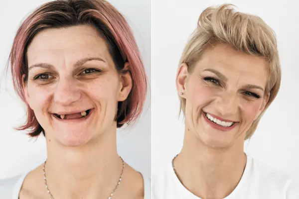 Makeover 2017. | Makeover 2017 | 