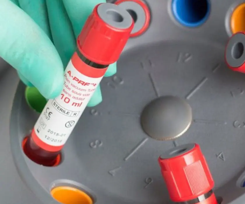 Oralna kirurgija | Stomatološka poliklinika Zagreb | Štimac centar dentalne medicine