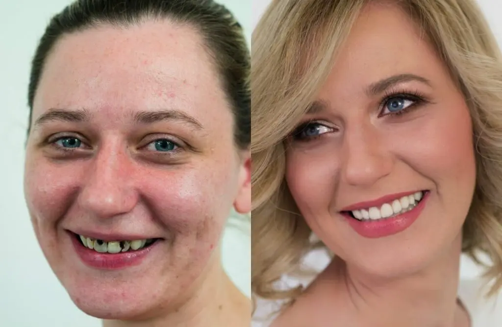 Makeover 2014. | Makeover 2014 | Stomatološka poliklinika Štimac | Zagreb | Valentina