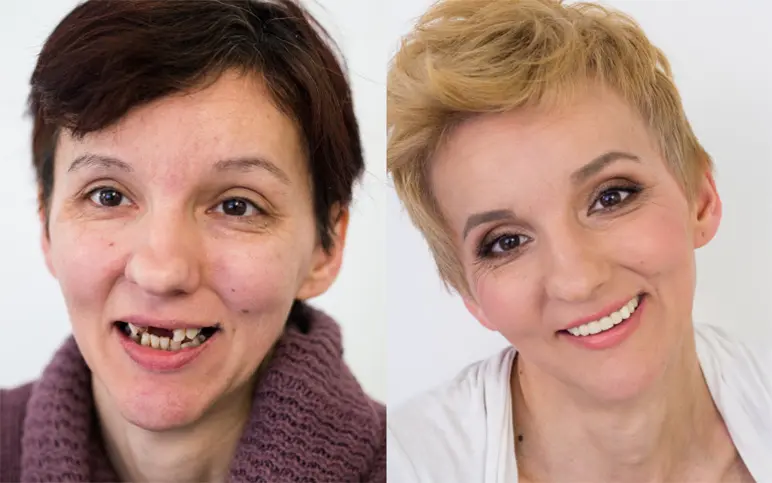 Makeover 2014. | Makeover 2014 | Stomatološka poliklinika Štimac | Zagreb | Slavica